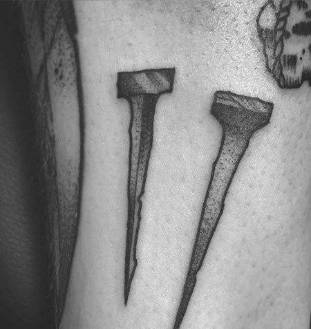 小腿后侧点刺钉子