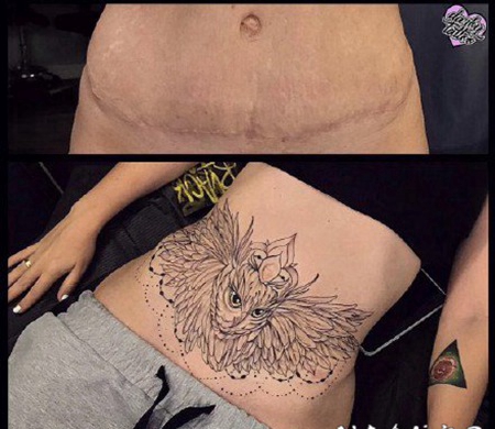 女性腹部伤疤遮盖的纹身效果图