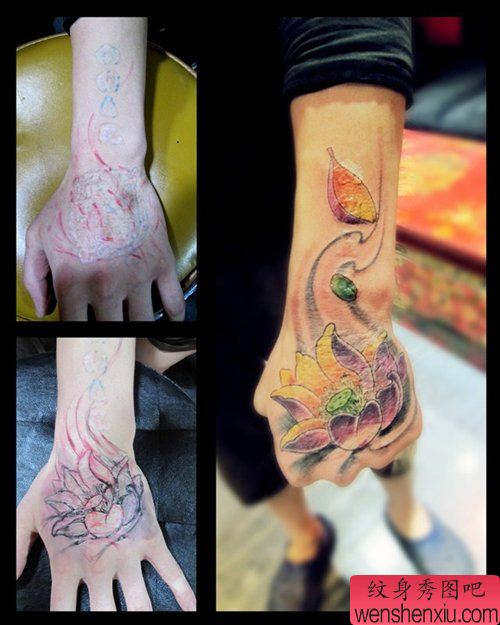 男生手背疤痕遮盖－莲花纹身图案