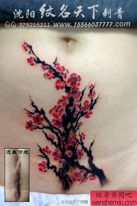 女性腹部疤痕遮盖－唯美流行的梅花纹身图案