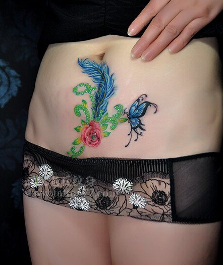 性感美女腹部蝴恋花纹遮盖剖腹产疤痕