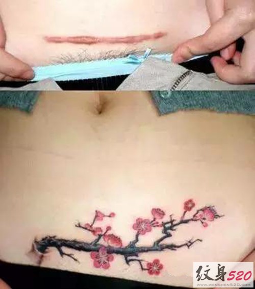 创意腹部伤疤遮盖纹身