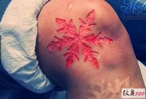这样的割肉纹身  你敢挑战吗