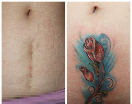 玫瑰花图案腹部剖腹产疤痕遮盖纹身