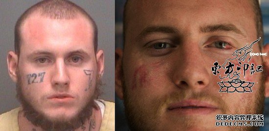 美国男子欲重新做人 用钢丝去除脸上纹身