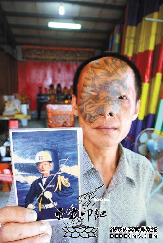 台湾男子脸部烧伤 用纹身皮肤植皮救命