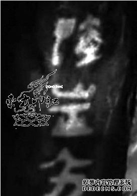 女尸现文字纹身 神秘难解成破案关键