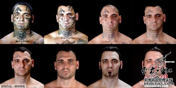 美黑帮头目为爱去除纹身 忍痛25次做激光手术