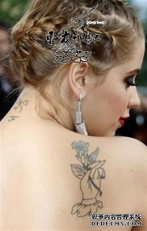 国外激光去除纹身  痛苦且花费高昂