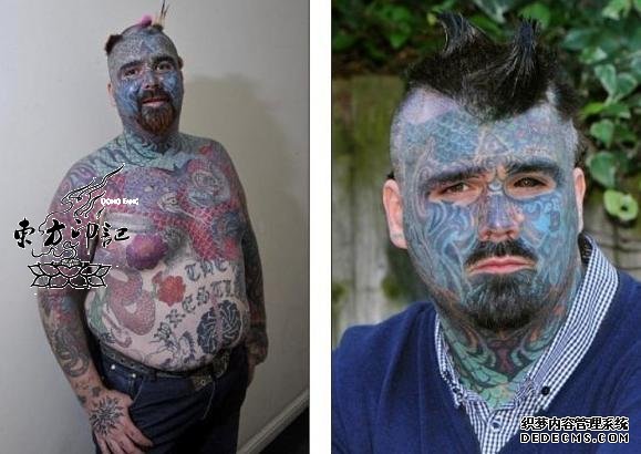 英国纹身男子将3D硅胶植入胸部