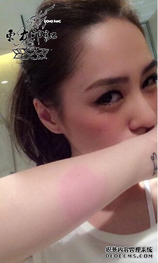 纹身八卦：阿娇晒跳蚤咬伤，关注点变纹身