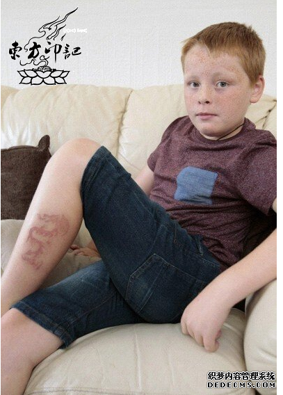 英国12岁男孩游玩埃及，彩绘纹身导致皮肤感染