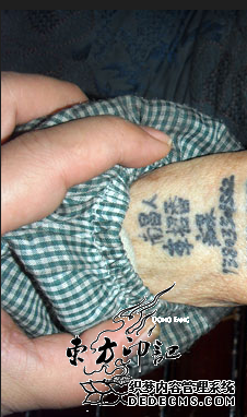 巧用电话号码纹身，让痴呆儿子走丢后找回