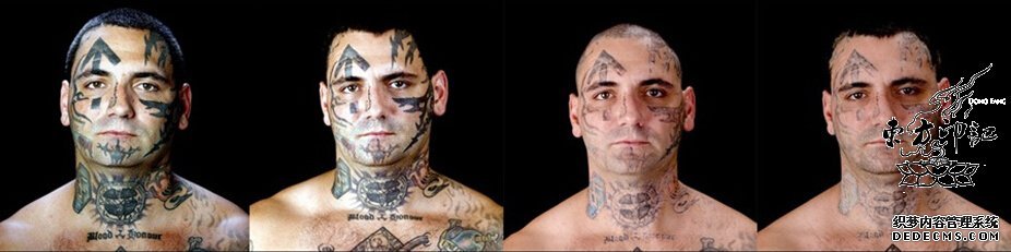 美国光头党头目25次手术去除面部纹身，要“从良