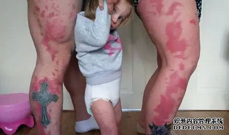 胎记纹身,英国夫妇做和女儿胎记一样的纹身