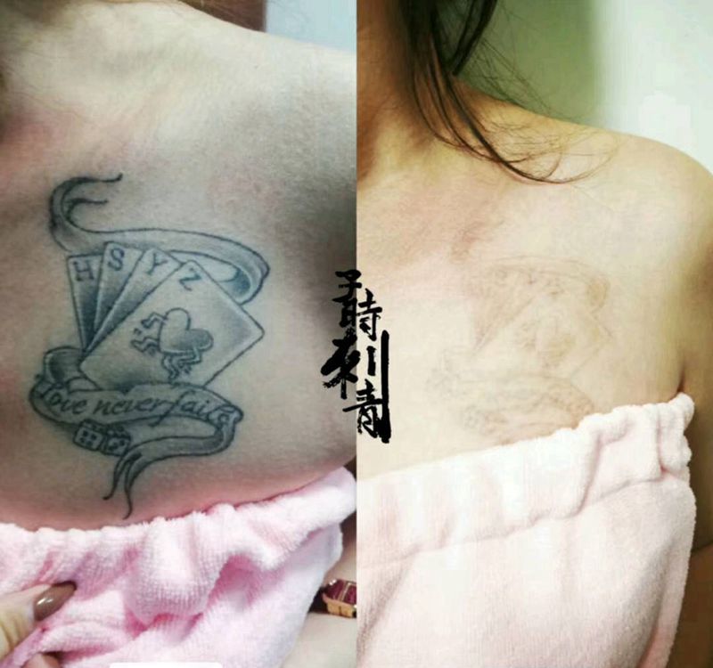 洗纹身纹身图片_肩部洗纹身纹身图案