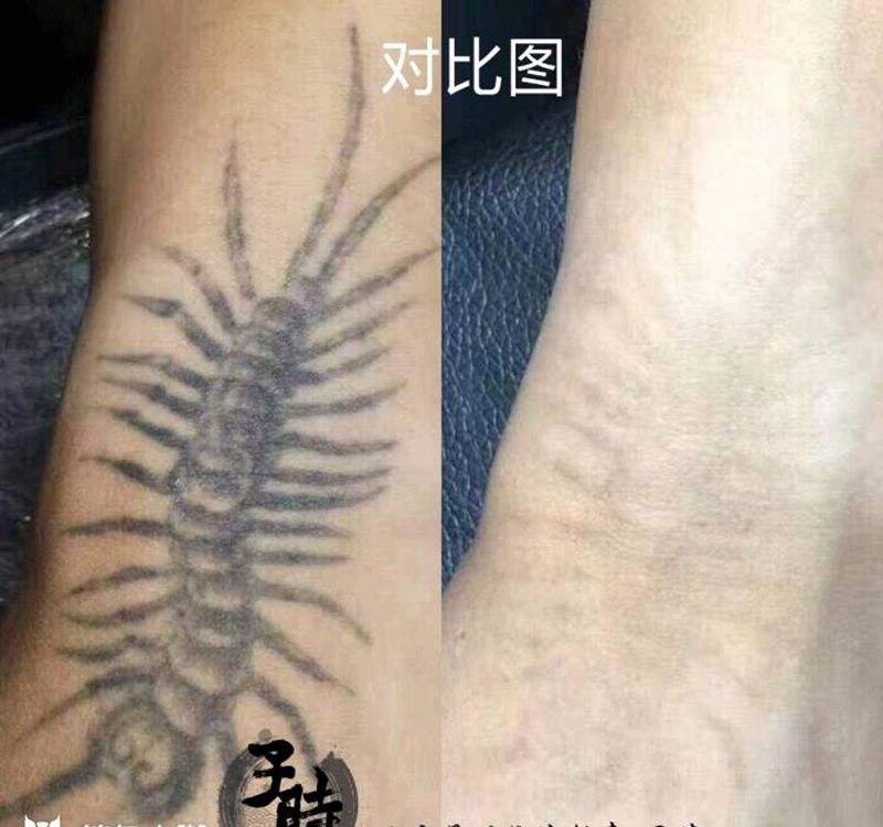 洗纹身纹身图片_手臂洗纹身成品纹身图案