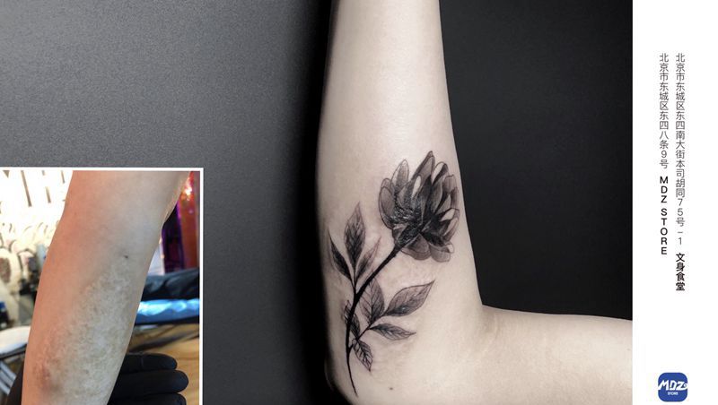 疤痕遮盖纹身图片_手臂疤痕遮盖纹身图案