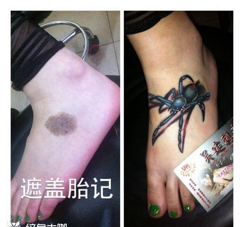 遮盖胎记纹身图片_