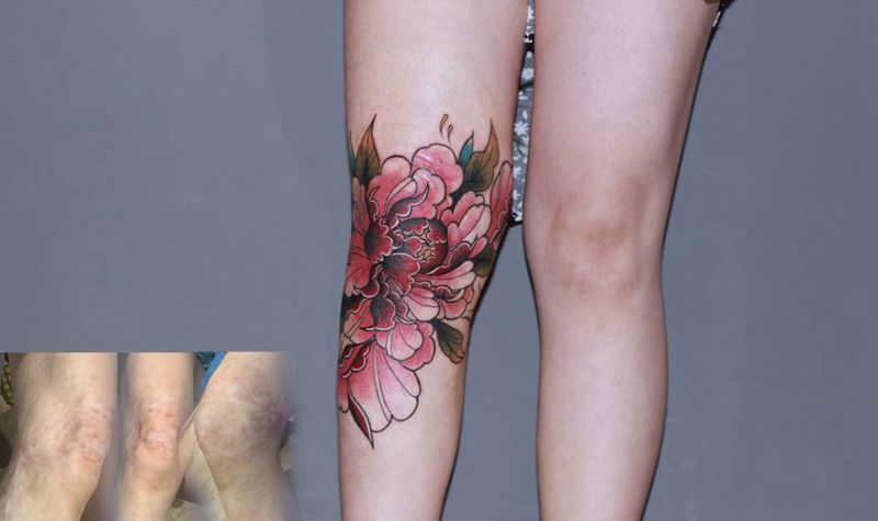 大腿疤痕遮盖纹身图片_腿部新传统纹身图案