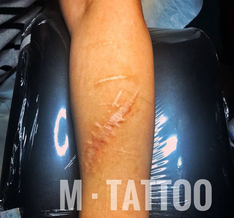 疤痕遮盖纹身图片