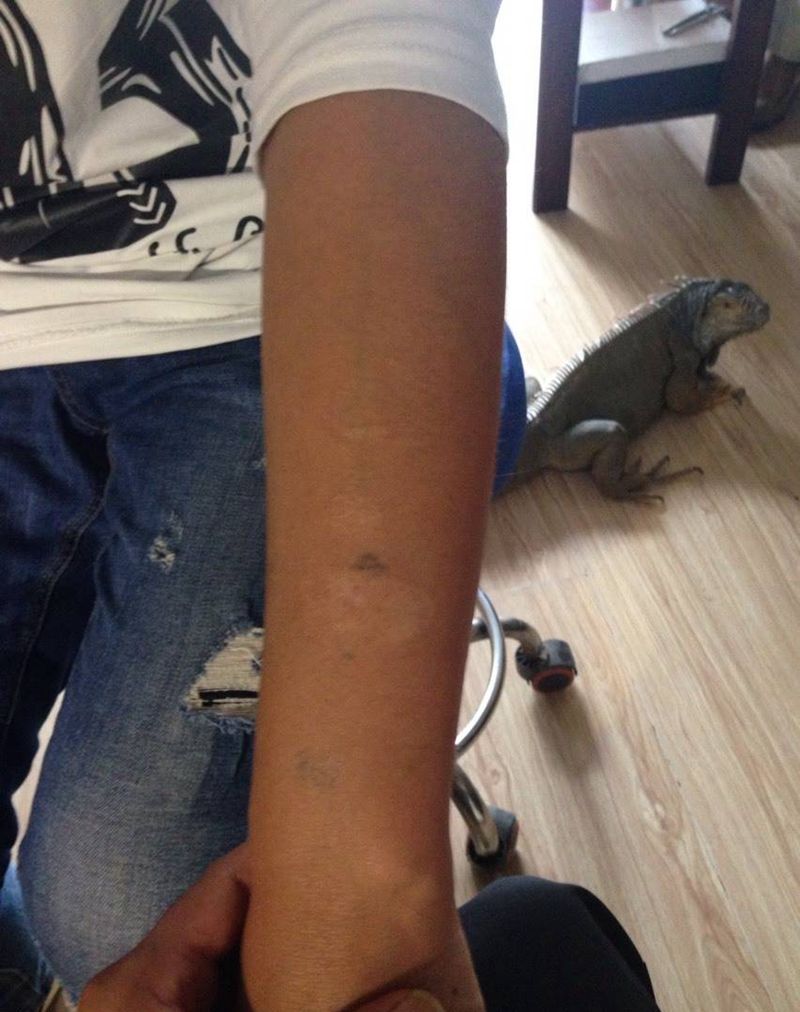 遮盖疤痕作品纹身图片