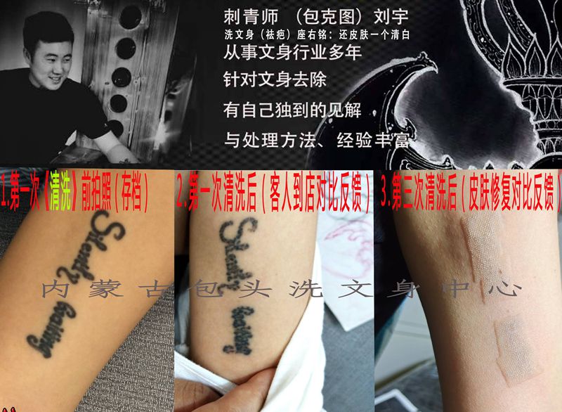 洗纹身图片_洗纹身图案