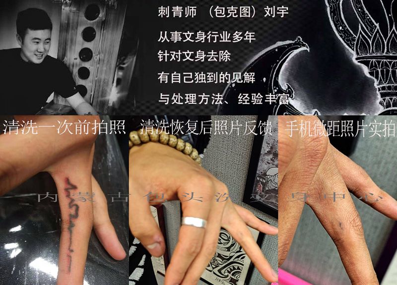 洗文身对比图纹身图片_洗纹身图案