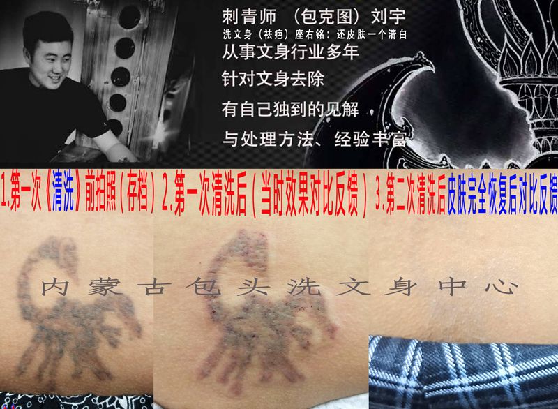 洗纹身图片_洗纹身图案