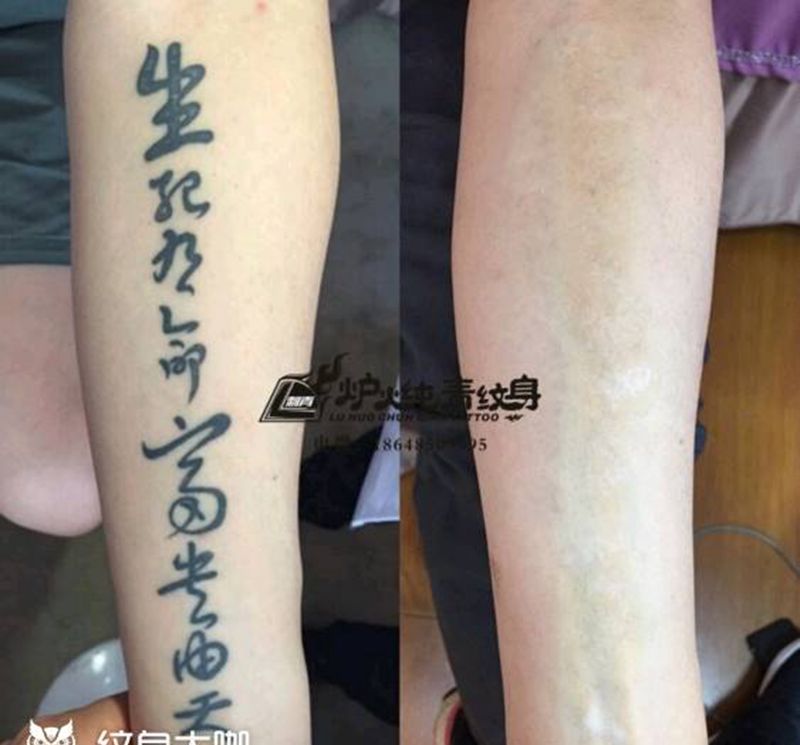 洗纹身纹身图片_洗纹身图案