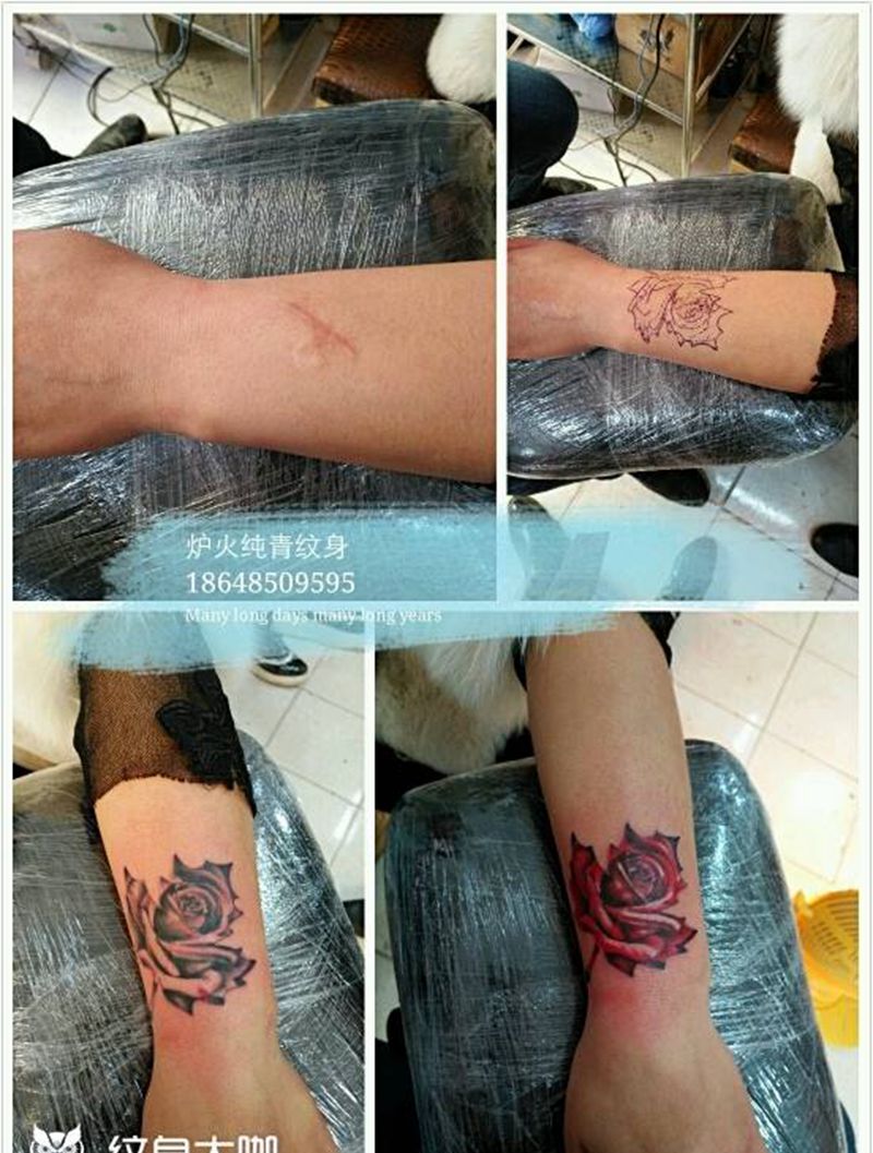 遮盖疤痕纹身图片