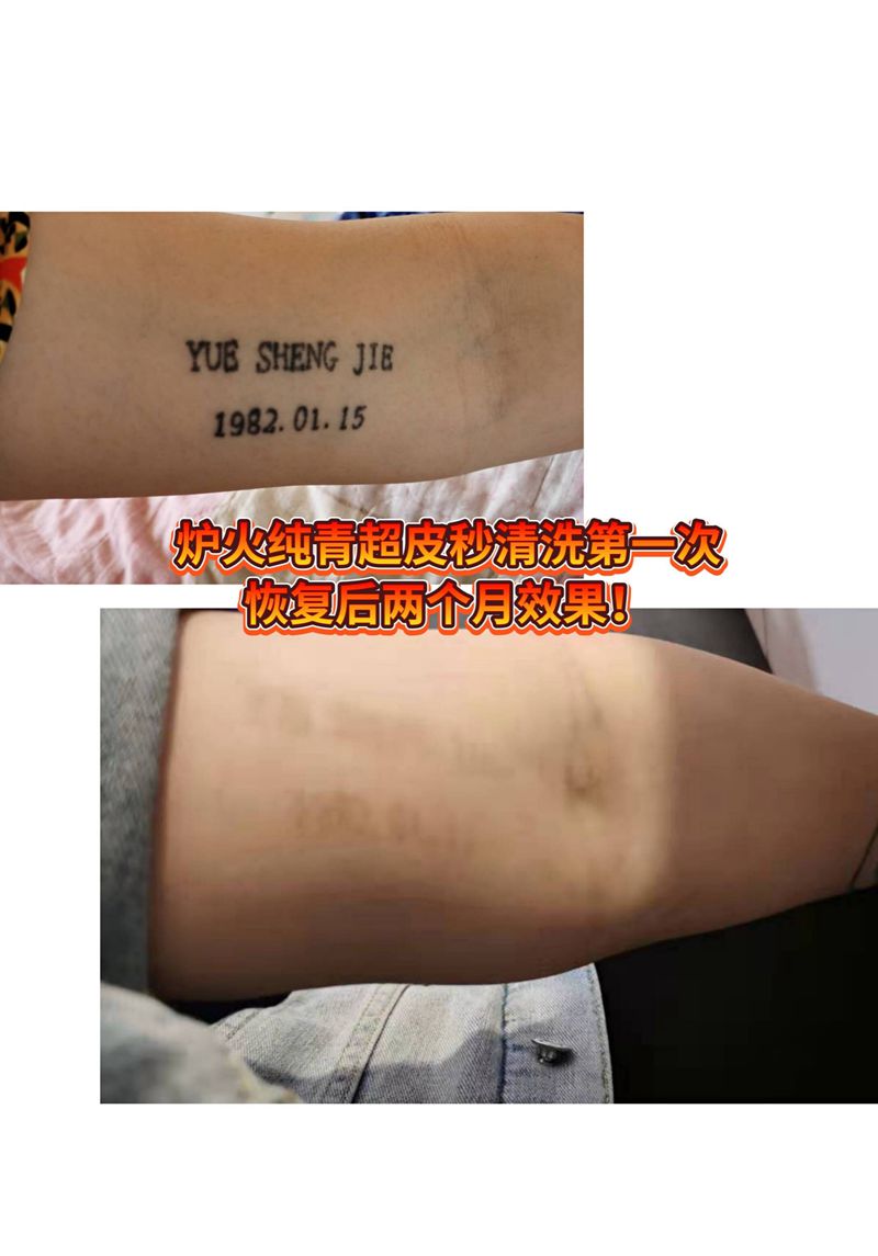 洗纹身一次效果纹身图片_手臂洗纹身图案