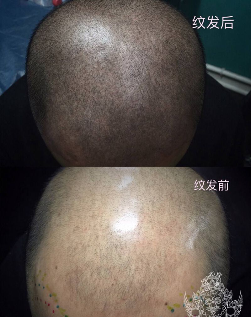 纹发第一次对比纹身图片_点刺纹身图案