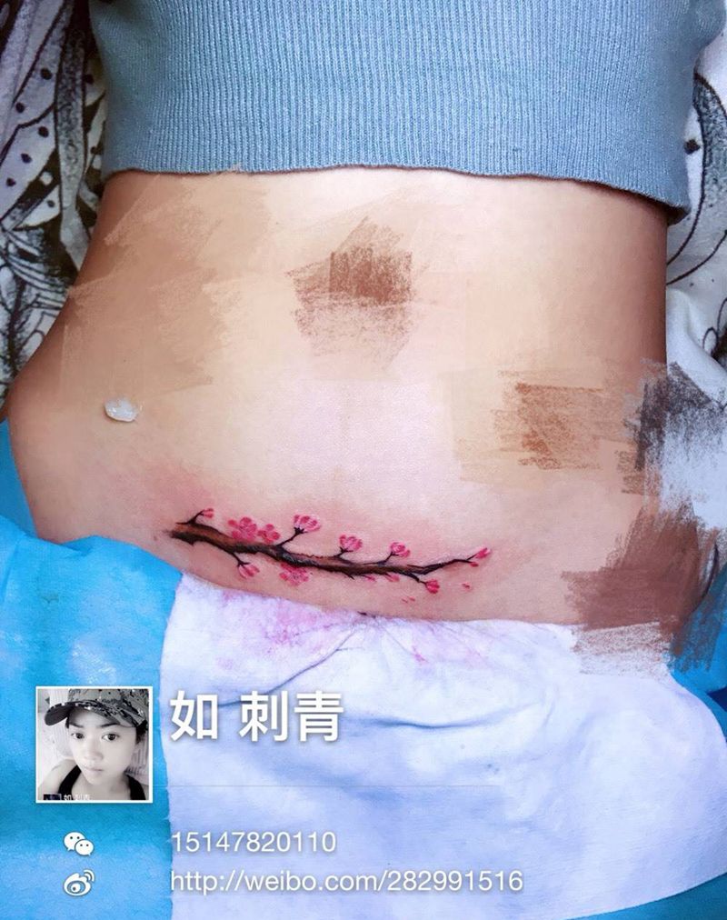 刨妇产疤痕遮盖纹身图片