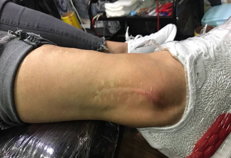 疤痕覆盖纹身图片