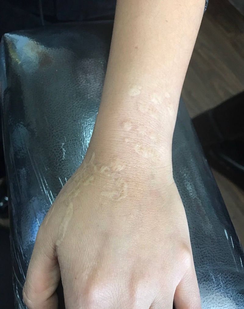 疤痕遮盖纹身图片