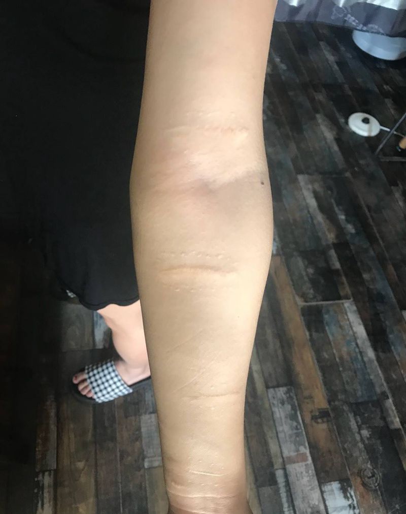 遮盖疤痕纹身图片