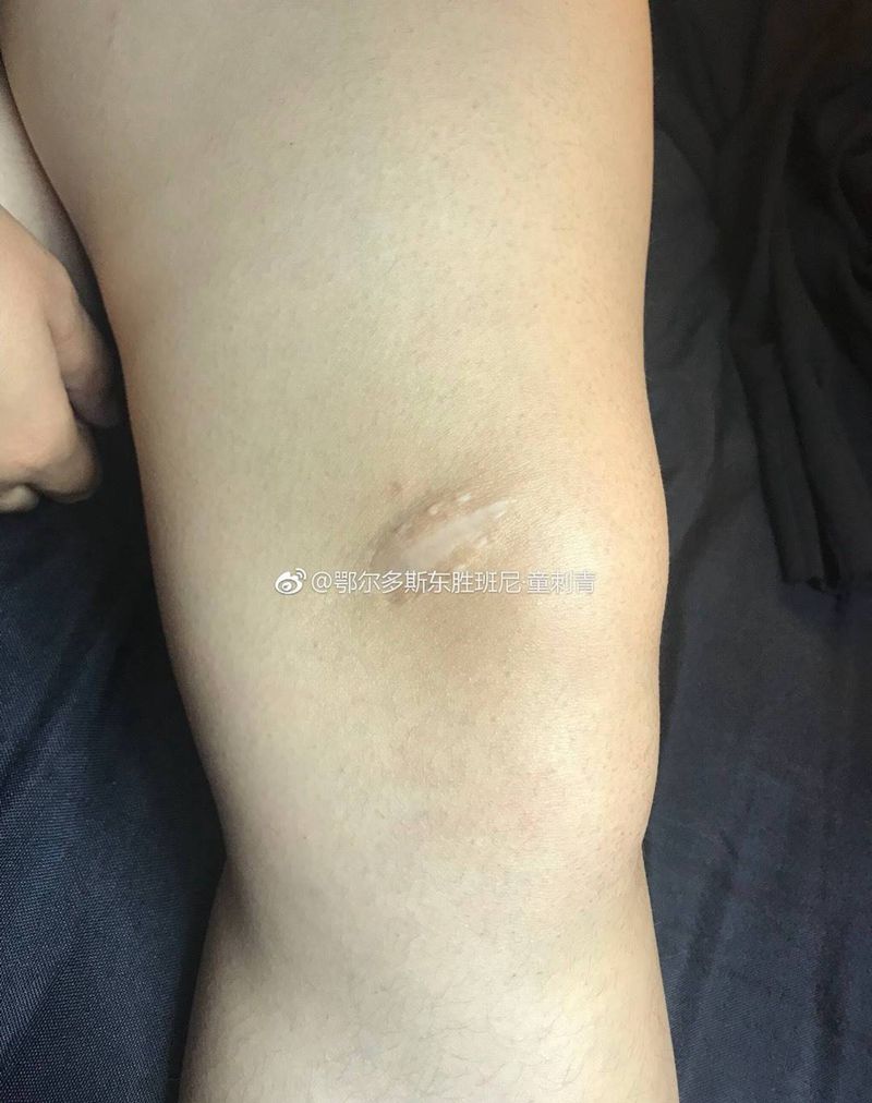 遮盖疤痕纹身图片