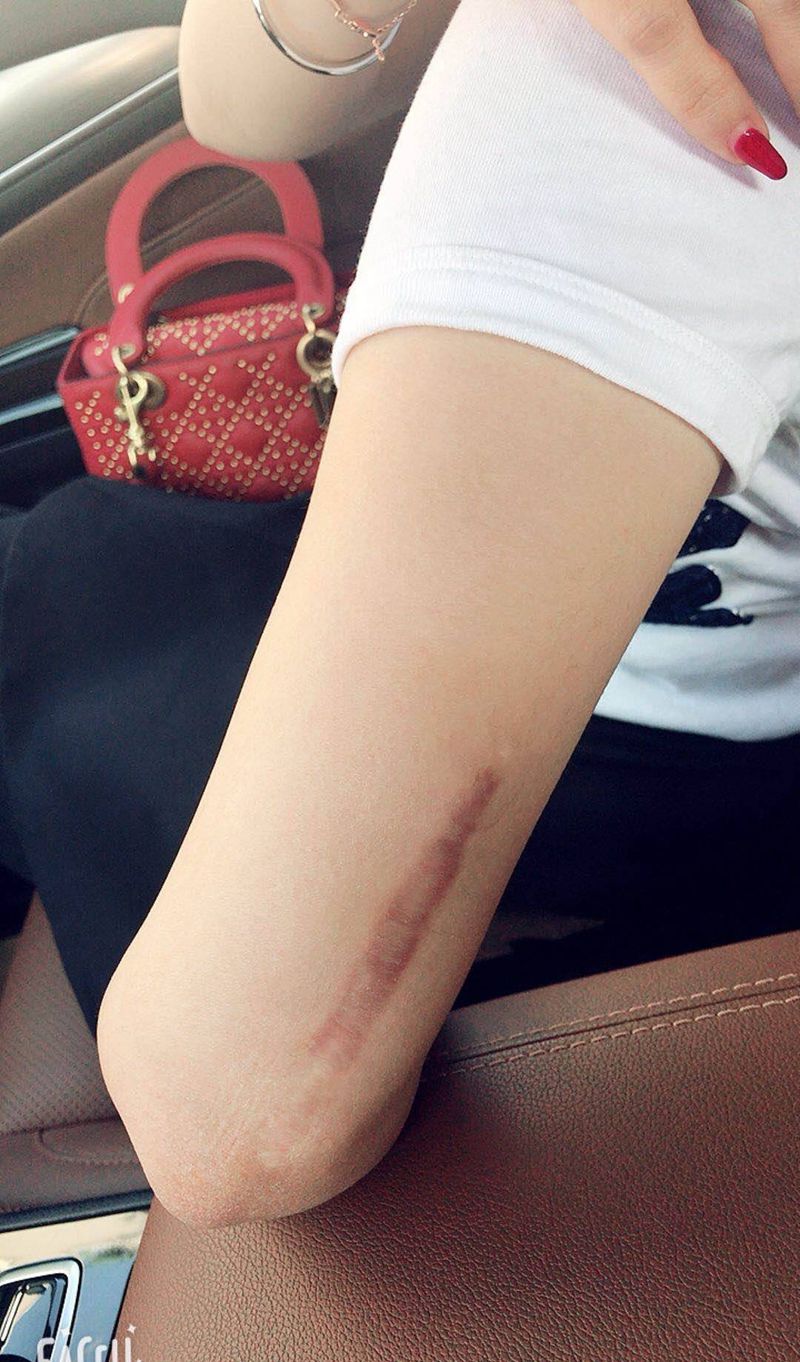 遮盖伤疤纹身图片