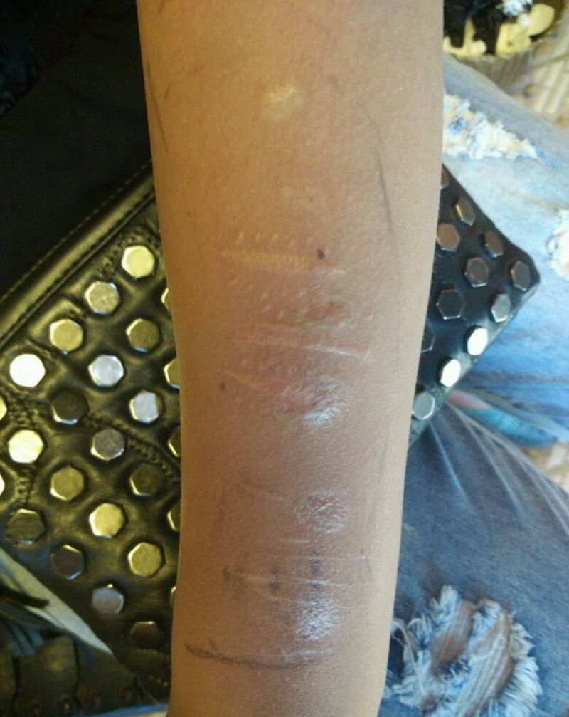 疤痕遮盖纹身图片_手臂传统动物成品纹身图案