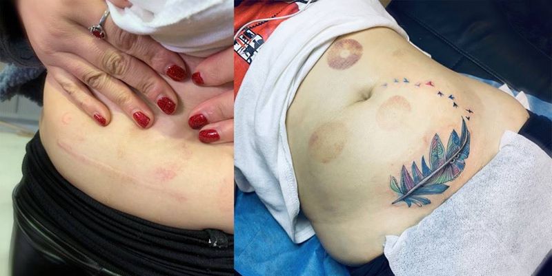 覆盖疤痕纹身图片