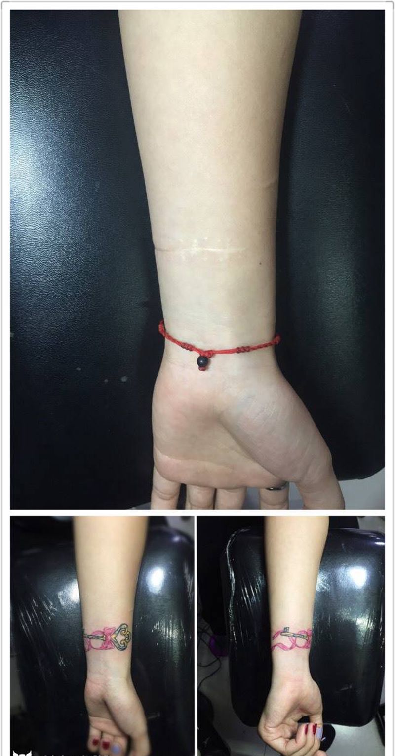 覆盖疤痕纹身图片