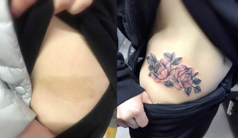 覆盖胎记纹身图片