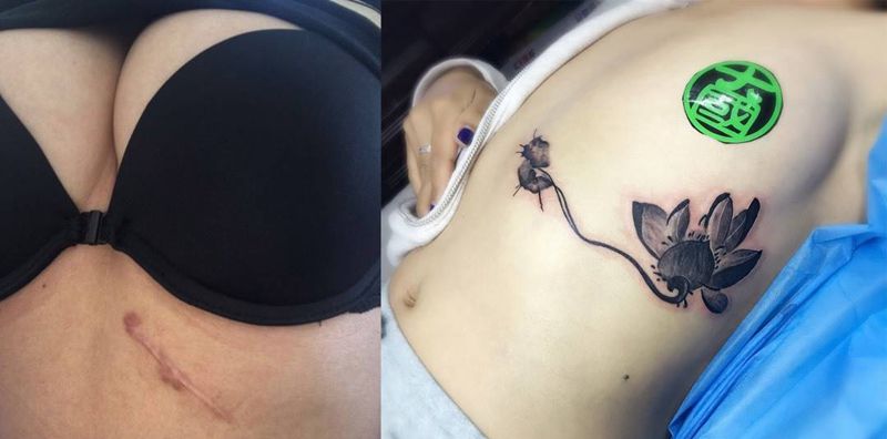 覆盖疤痕纹身图片