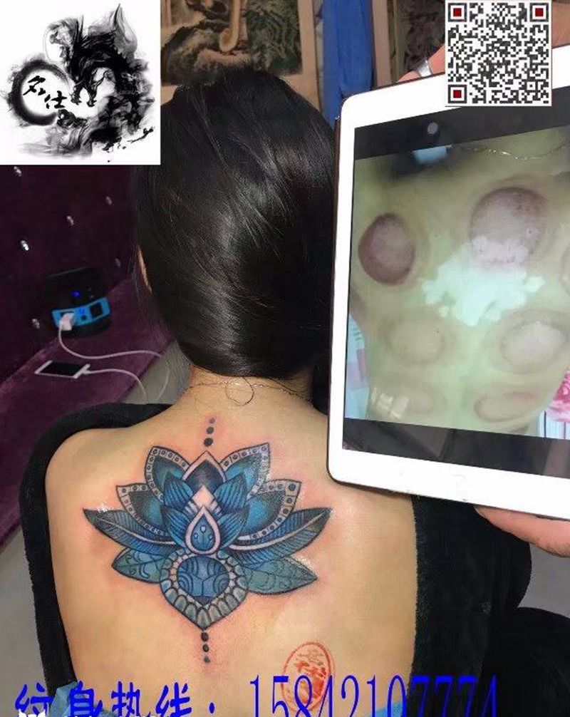 白癜风遮盖纹身图片