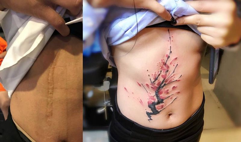 覆盖疤痕纹身图片