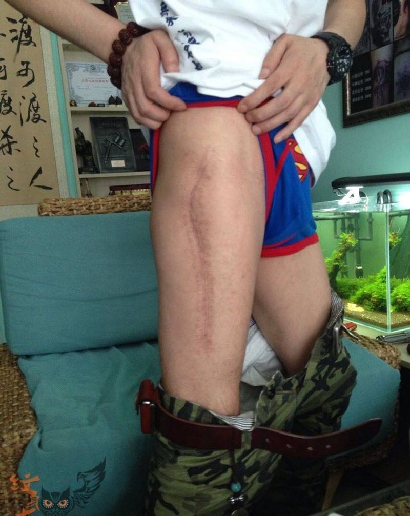 遮盖疤痕 老虎纹身图片