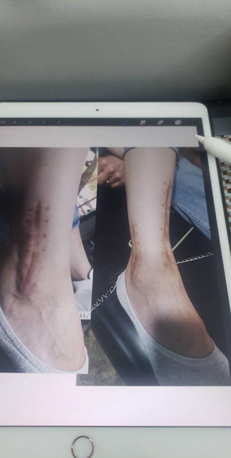 疤痕遮盖纹身图片_脚部腿部欧美写实New School纹身图案