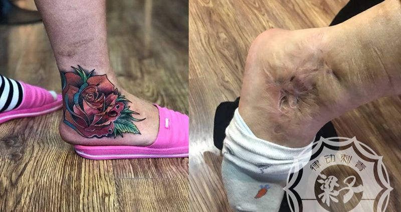 玫瑰花遮盖疤痕纹身图片_成品脚部欧美清新植物静物纹身图案