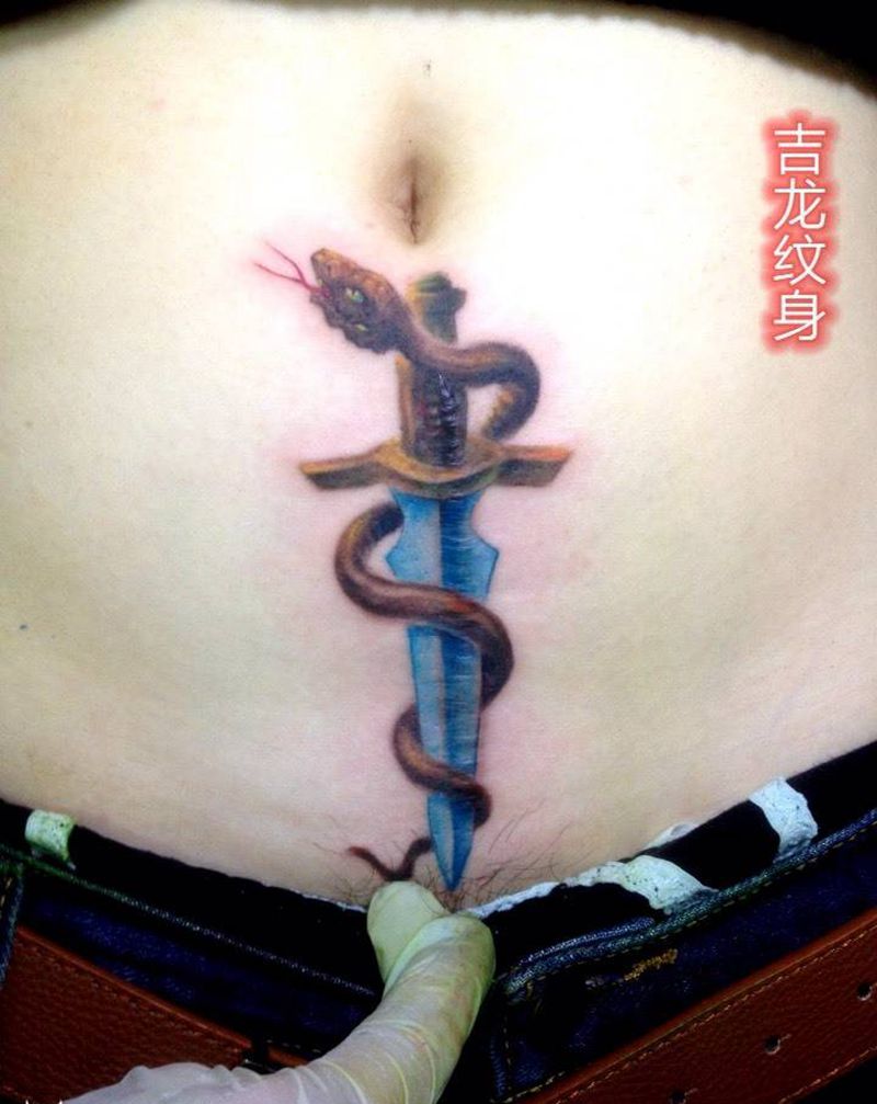 盖刨妇产疤痕纹身图片